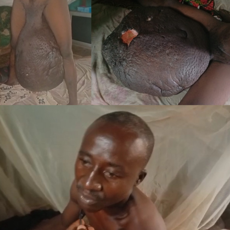 Video: Man’s Testicles Swollen After Sex In Bush At Gomoa Dawurampong